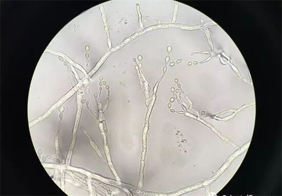 如何科学栽培构菌？需要注意哪些细节？