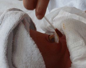 新生儿的脐带多久会掉？宝宝肚脐需要怎样的护理？